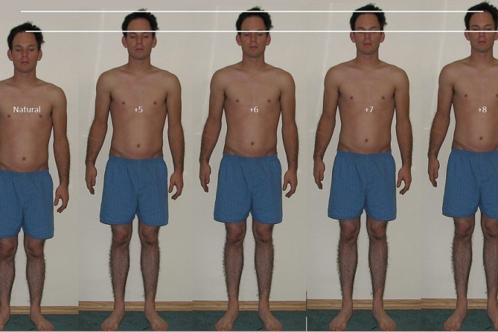 ESSENTIAL TO KNOW FACTS OF HEIGHT LENTHENING SURGERY