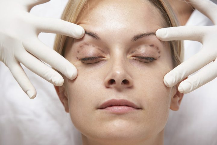 Important Things To Note About Eyelid Surgery