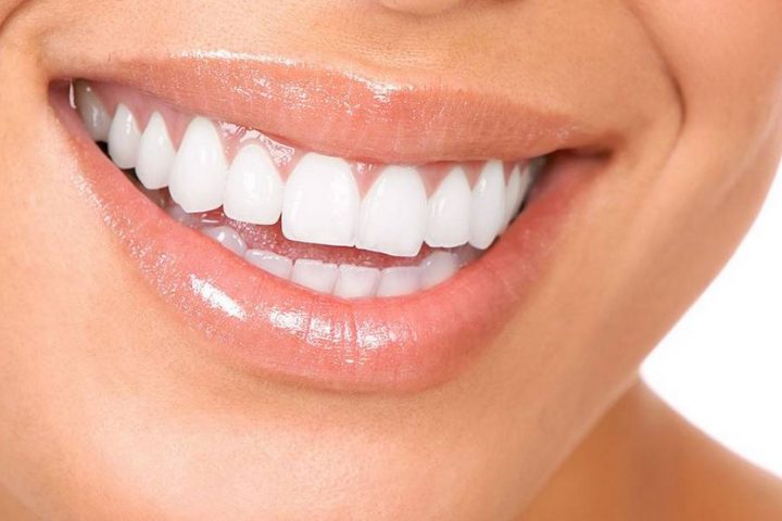 Rotting Teeth: 3 Reasons To Consider Dental Implants