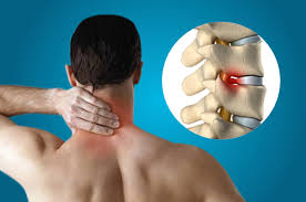 The Various Causes, Symptoms Of Spondylosis And Its Treatment